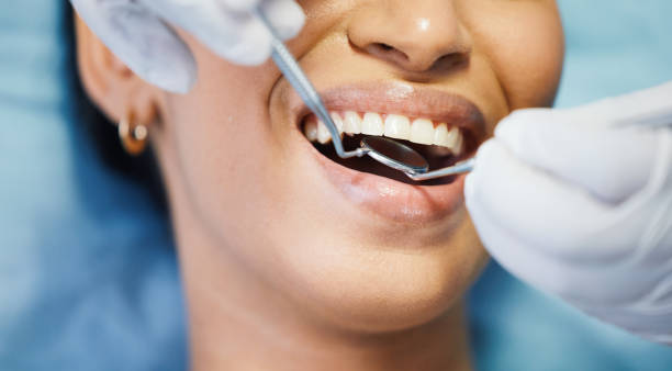 Best Emergency Dental Extractions in Cambridge, OH