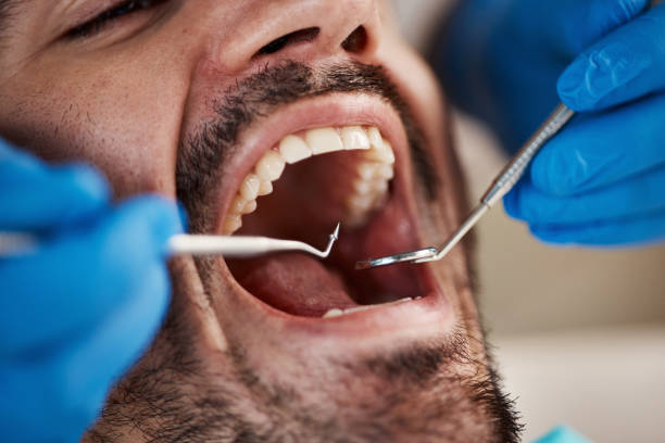 Best Broken or Cracked Tooth Emergency Dentist in Cambridge, OH